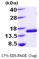 Human TTC11