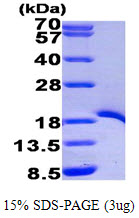 Human TRAF1