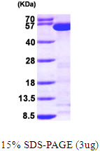 Human Tryptophanyl tRNA synthetase