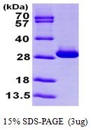 Human Triosephosphate Isomerase (TIM)