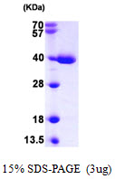 Human TXNL1
