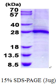 Human Troponin I