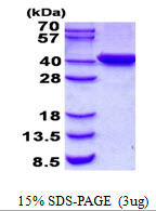 Human TYW5