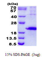 Human T-Cell Immunoglobulin Mucin Receptor 3 (TIM-3)
