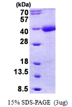 Human Tomoregulin-1 (TMEFF1)