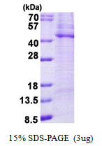Human Tyrosylprotein Sulfotransferase 2 (TPST-2)