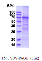 Human Transferrin Receptor (TFRC)