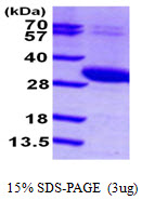 Human Uridine-Cytidine Kinase 2 (UCK 2)
