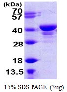 Human Ubiquitin Thioesterase L5 (UCH-L5)