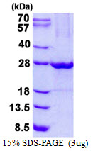 Human ULBP1