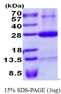Human ULBP4