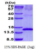 Human Uroplakin-2 (UP2)
