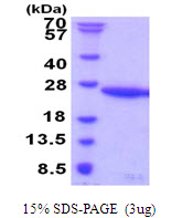 Human UBE2G1