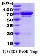 Human Ubiquitin Conjugating Enzyme 7 (UBC7)