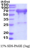 Human Ubiquilin-2 (UBQLN2)