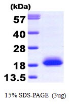 Human Visinin-like Protein 1 (VSNL1)