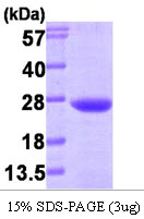 Human Vacuolar Protein Sorting-Associated Protein 28 Homolog (VPS28)