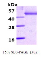 Human Vaspin (Serpin A12)