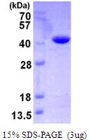 Human Vacuolar Protein Sorting-Associated Protein (VTA1) Homolog