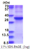 Human Zinc Finger Protein 32 (ZNF32)