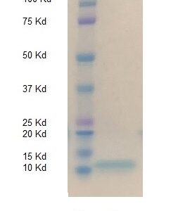 Biotinylated Human beta-2-Microglobulin (B2M)