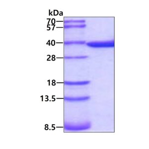 Mouse Annexin A5 (ANXA5)