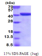 Mouse Annexin A1  (ANXA1)