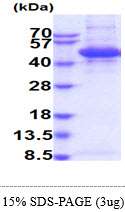 Mouse Fetuin-A (AHSG)