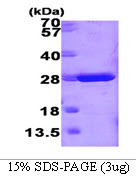 Mouse GSTM1