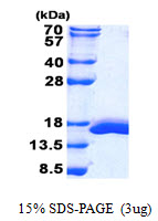 Mouse Galectin-2