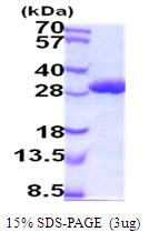 Mouse Glutathione S-Transferase A1 (GSTA1)