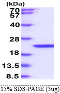 Mouse Interferon beta (IFN-beta)