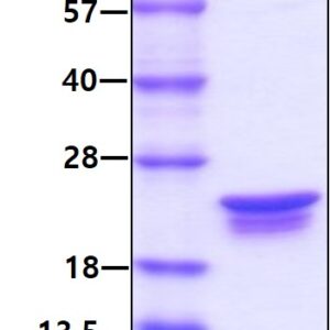 Mouse Interleukin-1 beta (IL-1 beta)