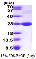 Mouse Lysophospholipase 1 (LPL-I)
