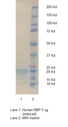 Human Retinol-Binding Protein (RBP)