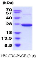 Rat Peroxiredoxin-2 (PRDX2)