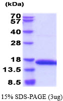 Rat Profilin-1 (Pfn1)