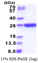Schistosoma japonicum Glutathione S-Transferase(GST)