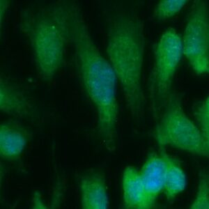 Human Pyruvate Dehydrogenase Kinase Isoform 1 (PDK1) Antibody (FITC Conjugate)