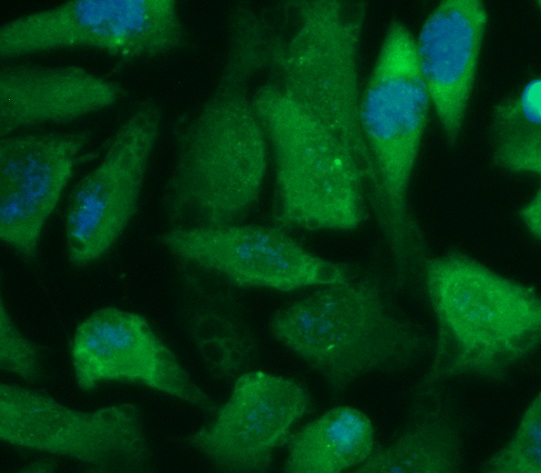 Human Galectin-3 (Gal-3) Antibody (FITC Conjugate) - Image 2