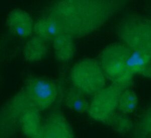 Human ALKBH3 Antibody (FITC Conjugate)