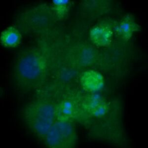 Human eIF5A Antibody (FITC Conjugate)