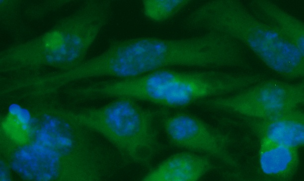 Human ADP-ribosylation Factor-like Protein 2-Binding Protein (ARL2BP) Antibody (FITC Conjugate)