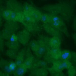 Human Copper Chaperone For Superoxide Dismutase (CCS) Antibody (FITC Conjugate)