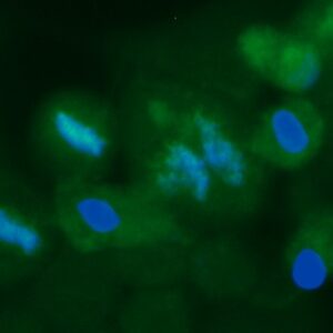 Human FABP5 Antibody (FITC Conjugate)