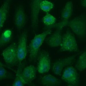 Human Sialylated Lewis A Antigen (CA 19-9) Antibody (FITC Conjugate)