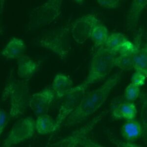 Human GGPS1 Antibody (FITC Conjugate)