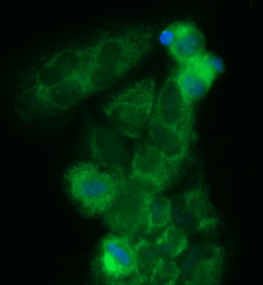 Human ECHS1 Antibody (FITC Conjugate)