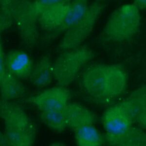 Human GNPDA 1 Antibody (FITC Conjugate)
