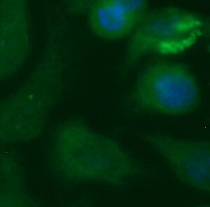 Human Cystatin-S (CST4) Antibody (FITC Conjugate)